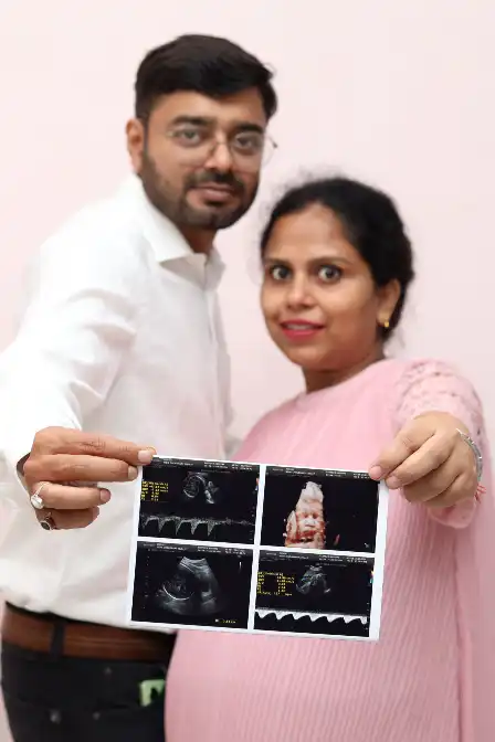 Pre Baby photography 3